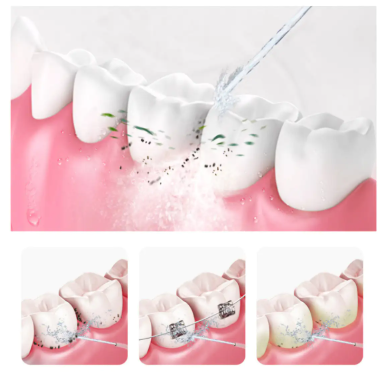Sootiva Water Flosser